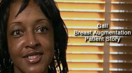 Breast Augmentation Patient Testimonial Video
