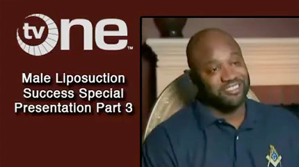 Male Liposuction Patient Testimonial Video