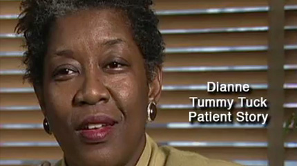 Tummy Tuck Patient Testimonial Video