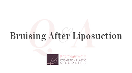 Body and Face NJ: Bruising After Liposuction