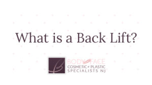 What is a Back Lift?