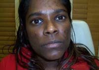 Before Chemical Peels